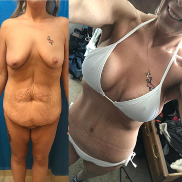 Slider image (7) Cancun Plastic Surgery Center by Dr. Víctor Sámano